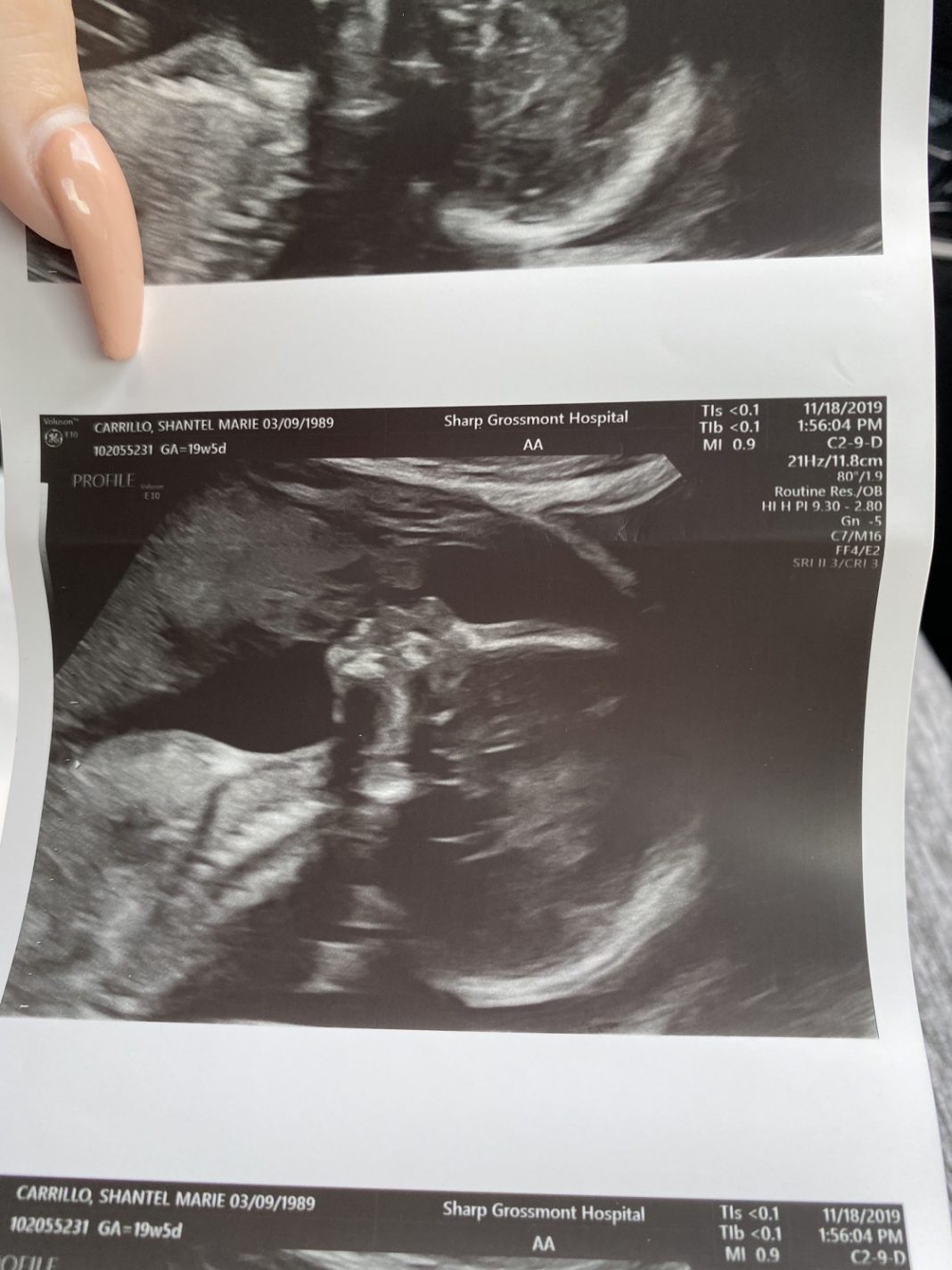gravida ve pai falecido beijando seu bebe no ultrassom e imagem viraliza - Grávida acredita que pai falecido apareceu beijando seu bebê no ultrassom